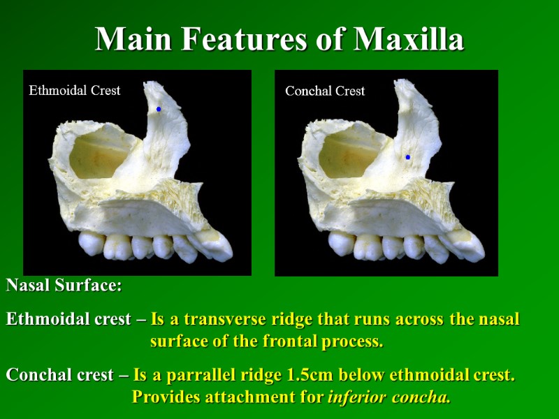 Main Features of Maxilla   Nasal Surface: Ethmoidal crest – Is a transverse